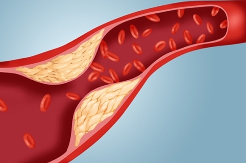 Холестерин